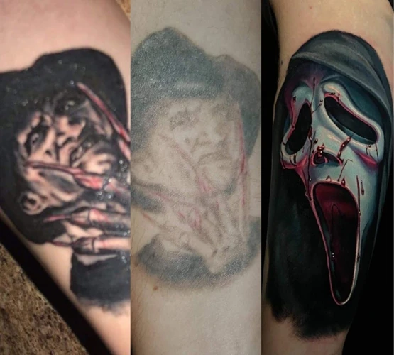 Causes Of Dark Tattoos