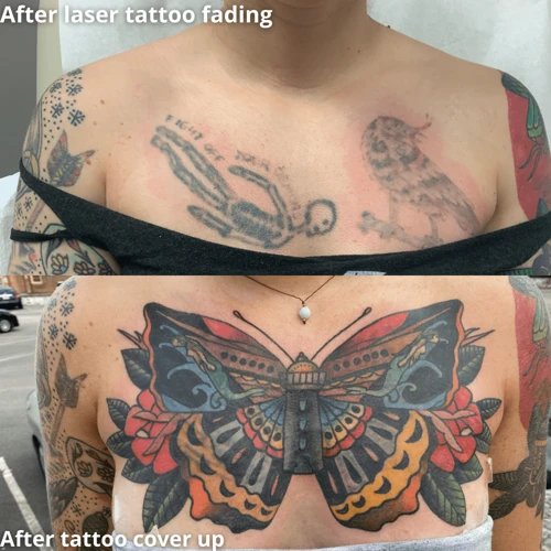 How Hard Is It To Cover Up A Black Tattoo?