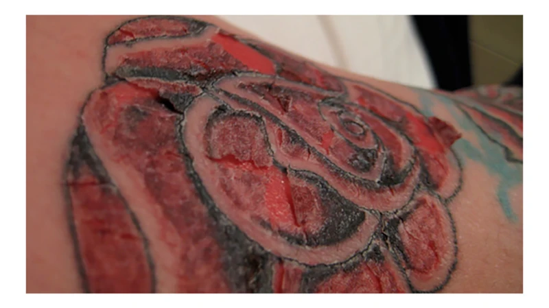 How To Test Tattoo Ink
