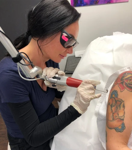 Setting Up Your Tattoo Removal Business