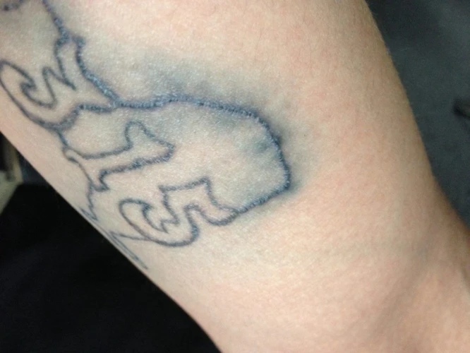 What Causes Tattoo Ink To Bleed