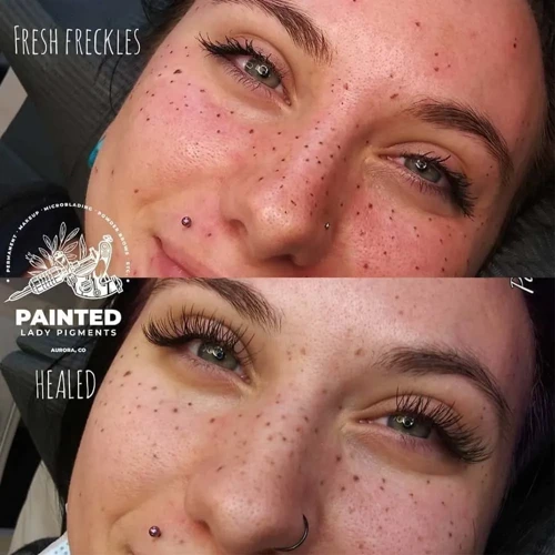 Where Can You Get Freckle Tattoos?