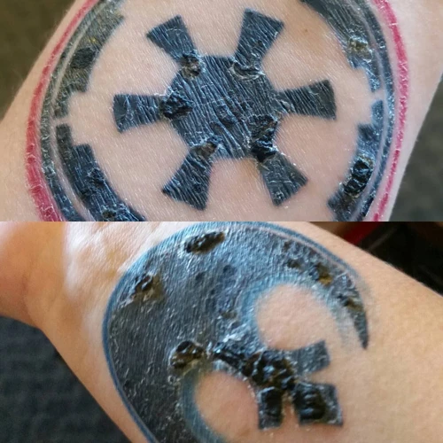 Why Is My Tattoo Drying Out So Fast?